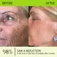 BOTOX & VITA A RETINOL SHOT Wrinkle Lift Tightening Cream - Image 37