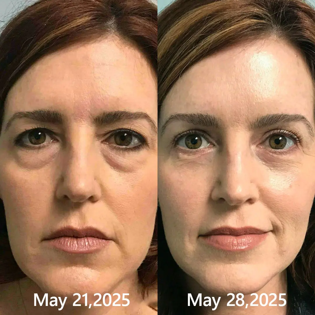 BOTOX & VITA A RETINOL SHOT Wrinkle Lift Tightening Cream - Image 51