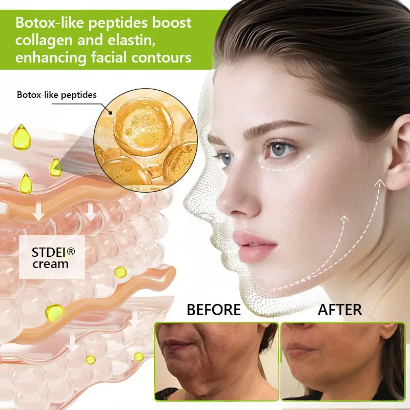 BOTOX & VITA A RETINOL SHOT Wrinkle Lift Tightening Cream - Image 60