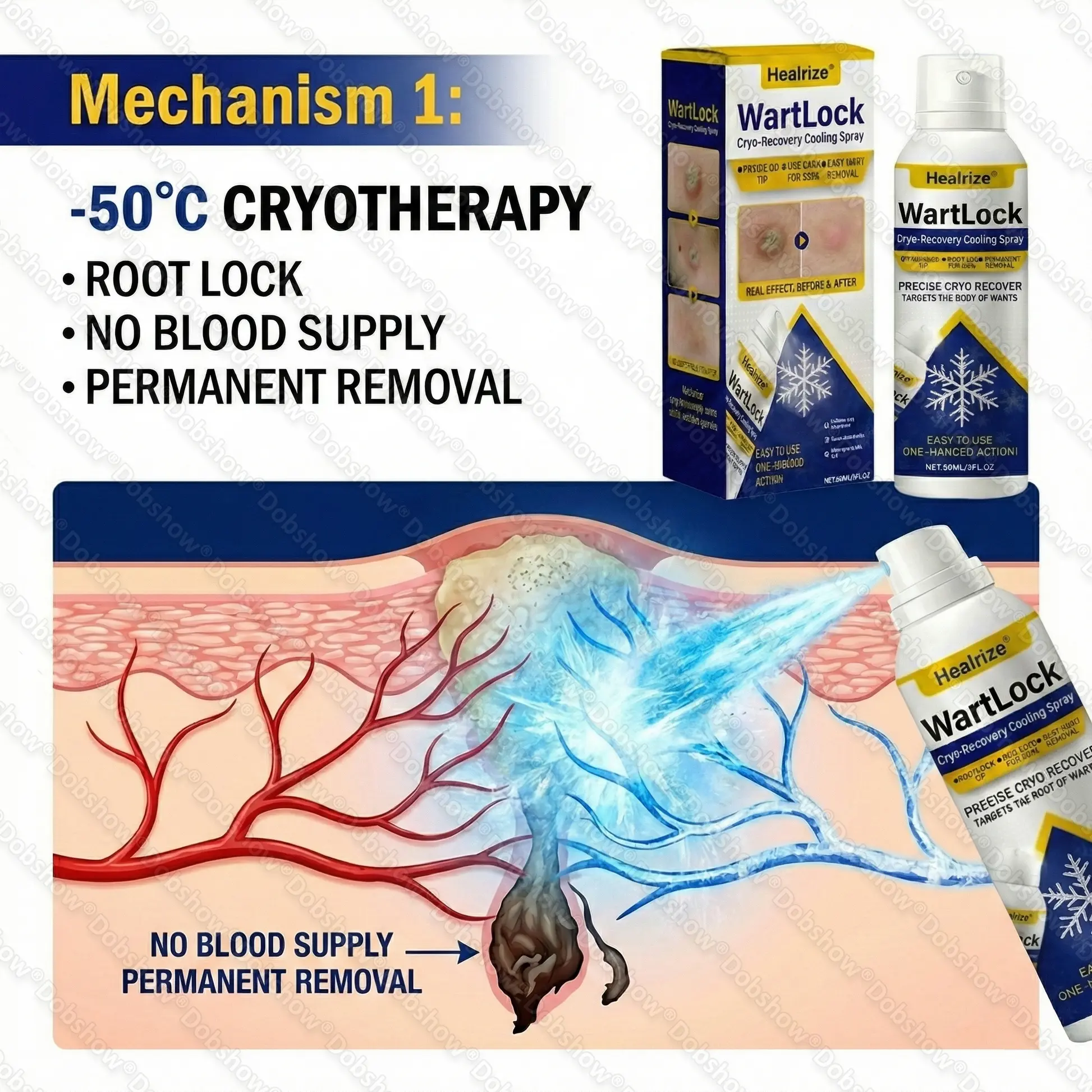 🔥Best WartLock Cryo-Recovery Cooling Spray🎉Special limited-time discount - Image 4