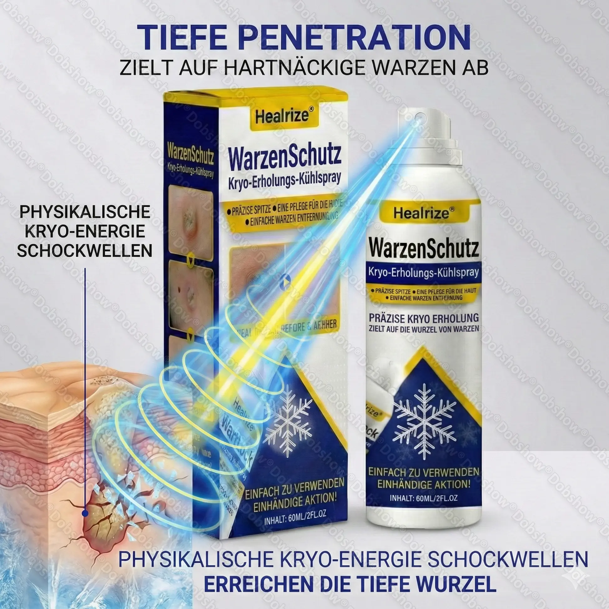 WartLock Kryo-Recovery Kühlspray🎉 Zeitlich begrenzter Sonderrabatt - Image 5