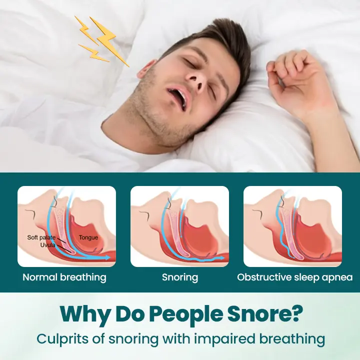 SilentBreathe Anti-Snore Patch - Image 2