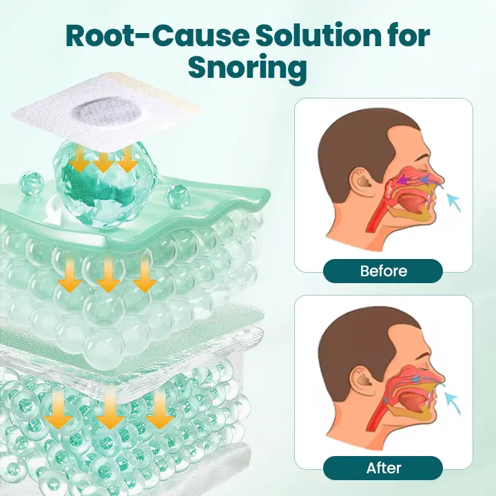 SilentBreathe Anti-Snore Patch - Image 4