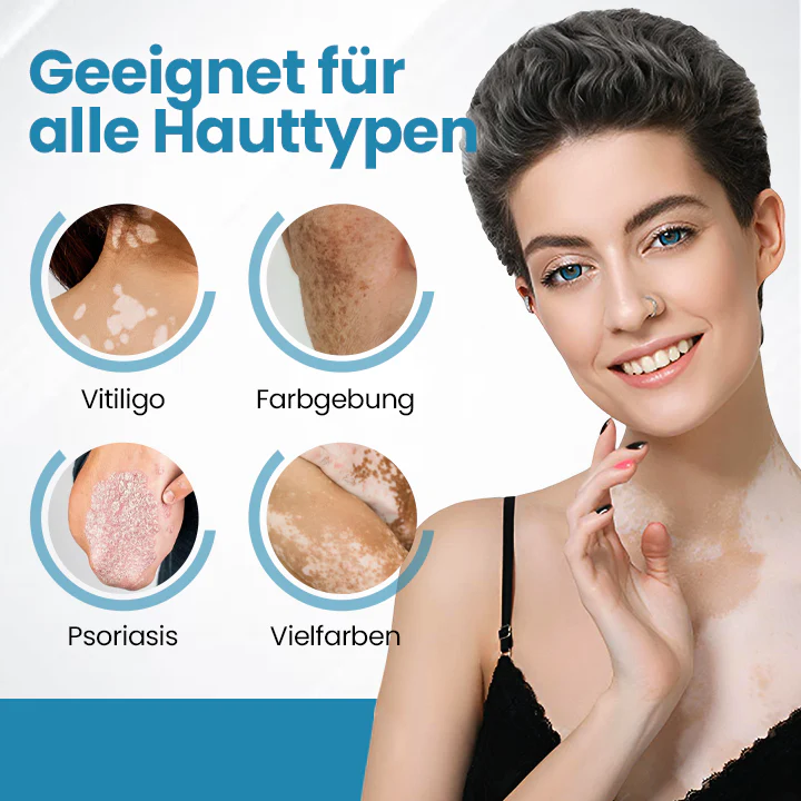 DermaBeam Vitiligo-Therapiegerät - Image 3