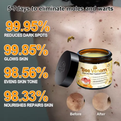 Bee Venom Mole and Wart Treatment Cream - Image 7