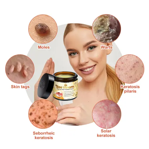 Bee Venom Mole and Wart Treatment Cream - Image 8