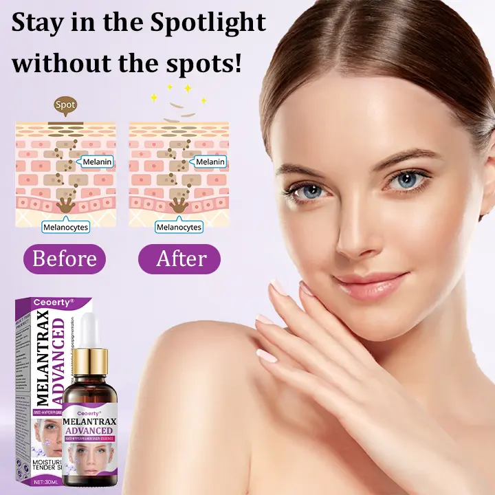MelantraX Advanced Anti-Hyperpigmentation Essence - Image 5
