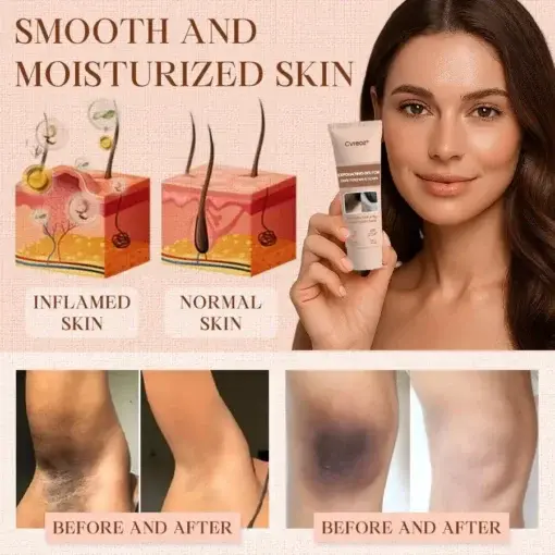 Purifying Exfoliating Gel for Acanthosis Nigricans, Exfoliation, Dark Spots, Skin Tags, and Eczema - Image 12