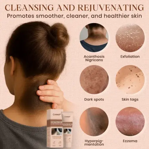 Purifying Exfoliating Gel for Acanthosis Nigricans, Exfoliation, Dark Spots, Skin Tags, and Eczema - Image 5