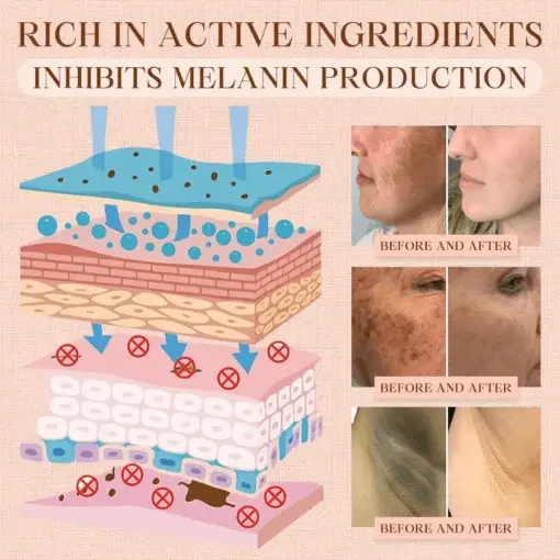Purifying Exfoliating Gel for Acanthosis Nigricans, Exfoliation, Dark Spots, Skin Tags, and Eczema - Image 9