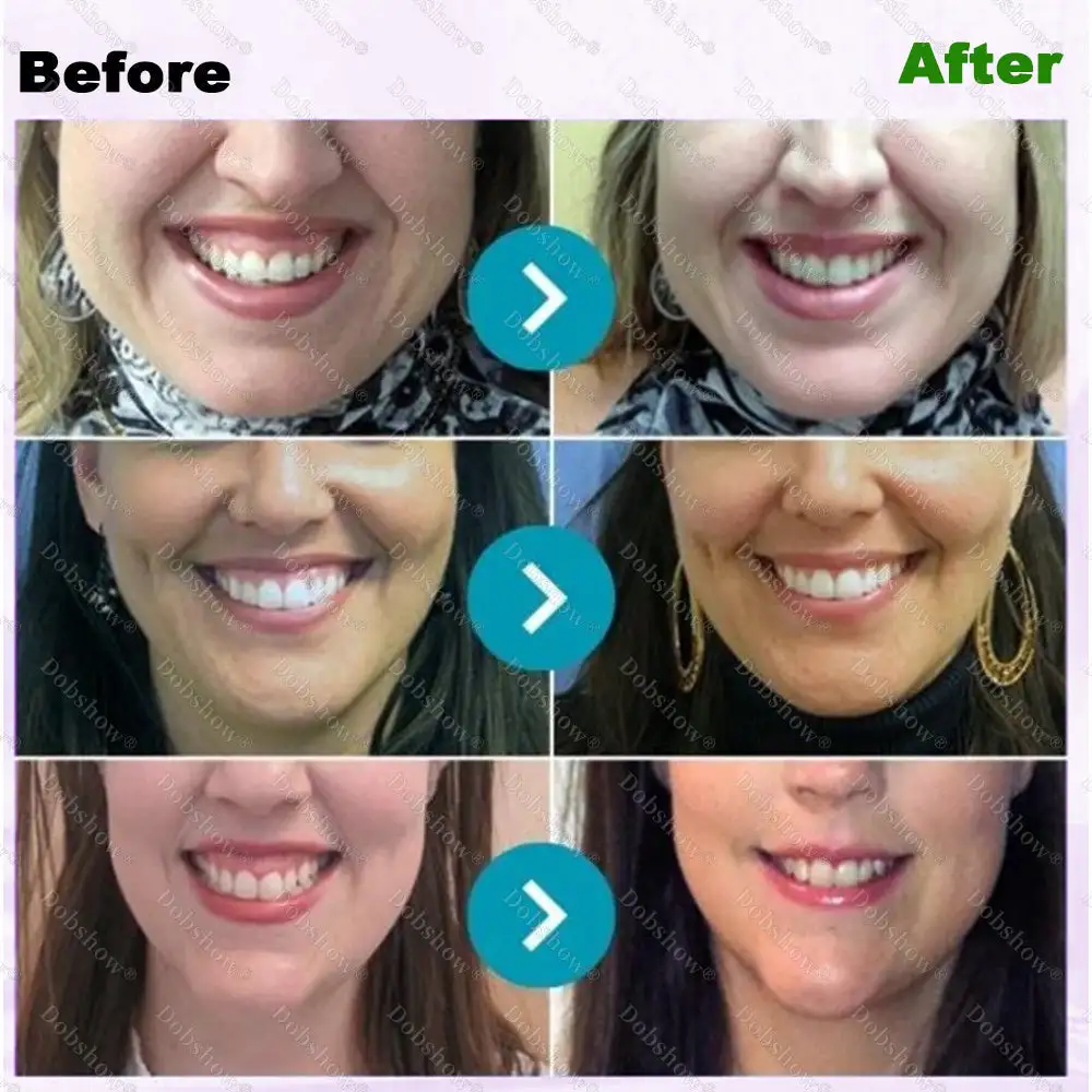 🐝 ApiCore BeeVenom Vital Repair Toothpaste - Image 4
