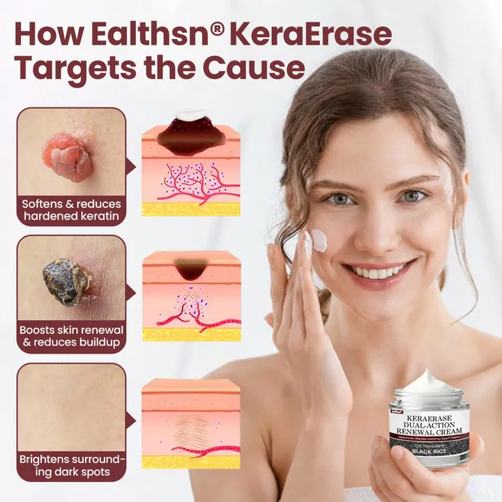 KeraErase Dual-Action Renewal Cream - Image 5