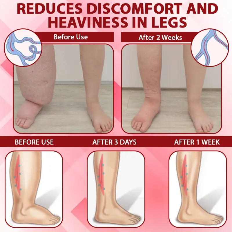 VenoLymph Massage Therapy Cream - Image 9