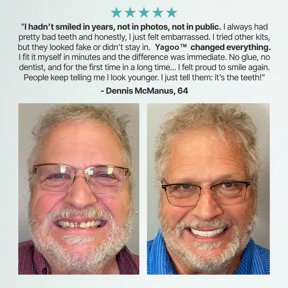 💗Ends Today: 70% OFF! Custom Custom-Fit Full Functional DenturesMake you more confident - Image 9