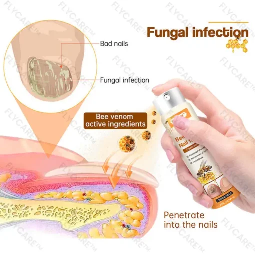 Bee Venom Nail Fungus Spray - Image 4