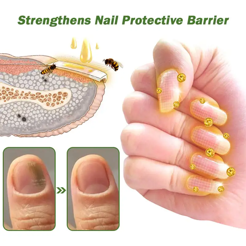 Nail Fungus Treatment Serum - Image 10