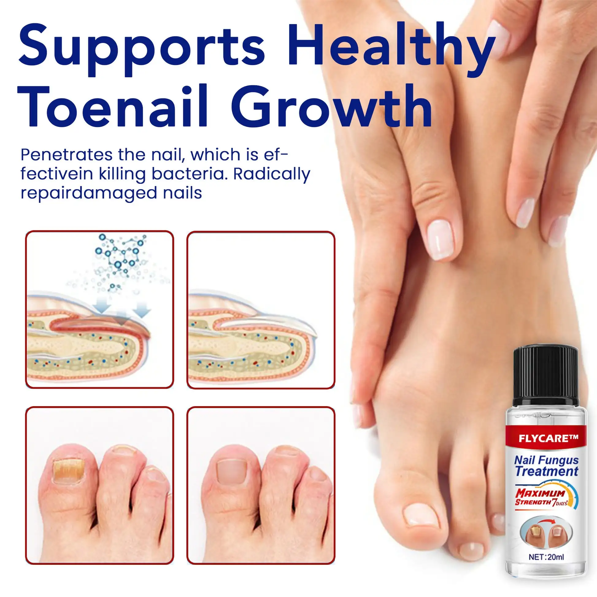 Nail Fungus Treatment Serum - Image 5