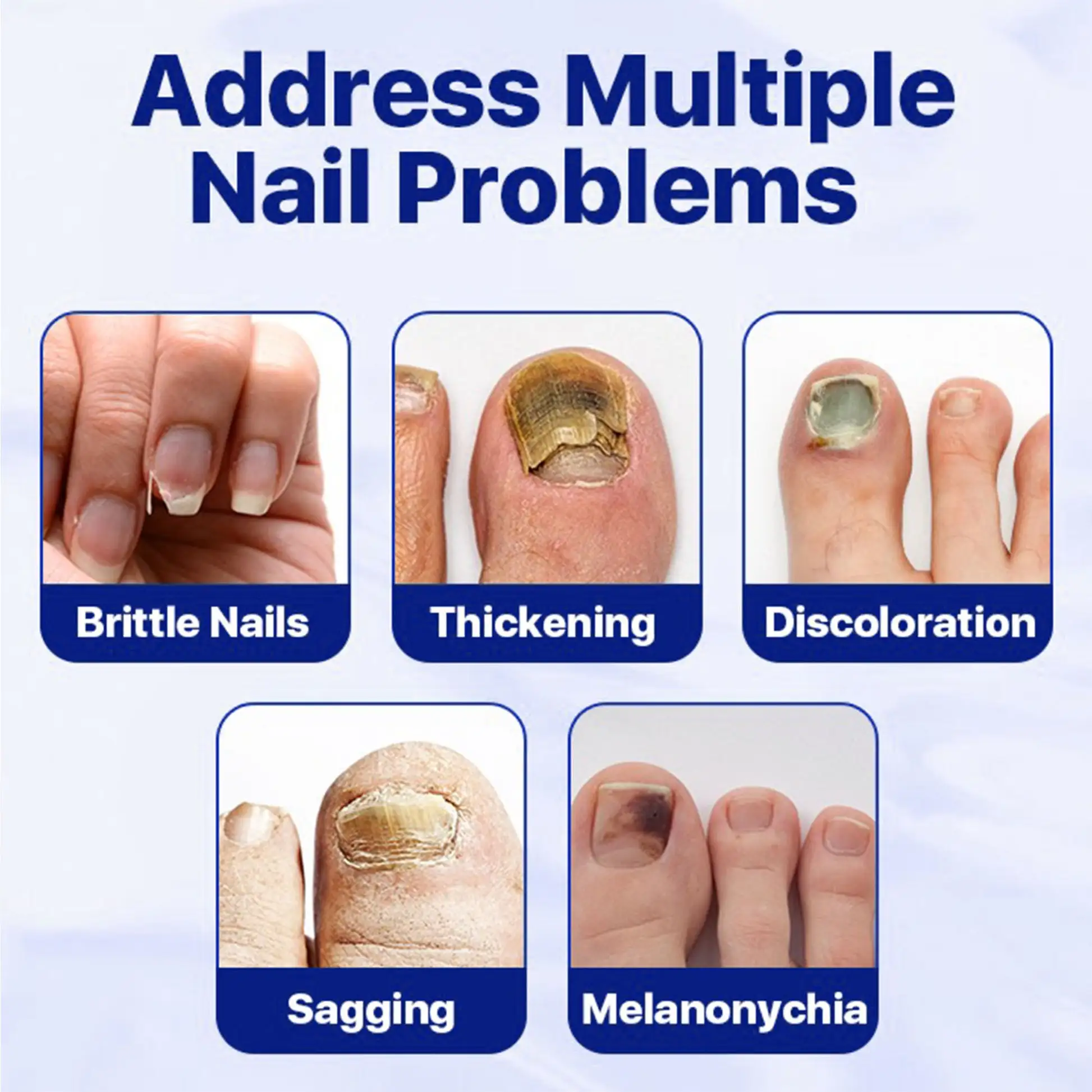 Nail Fungus Treatment Serum - Image 7