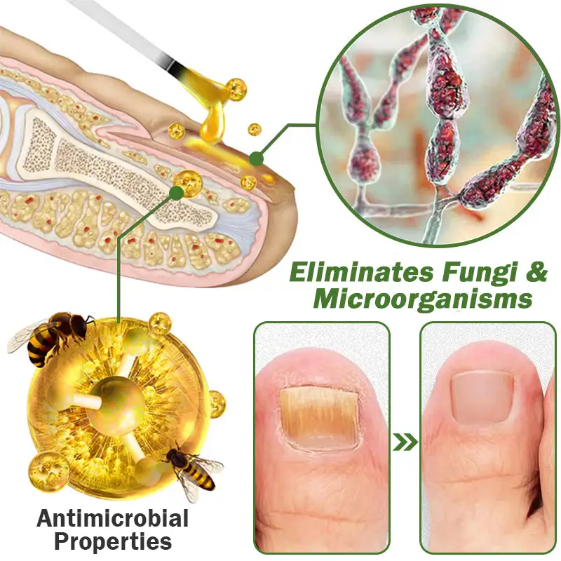 Nail Fungus Treatment Serum - Image 9