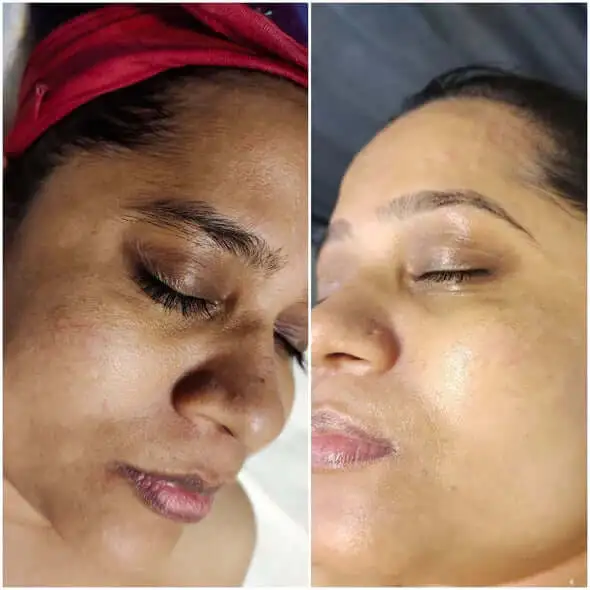 Melanin Correcting Facial Serum - Image 3