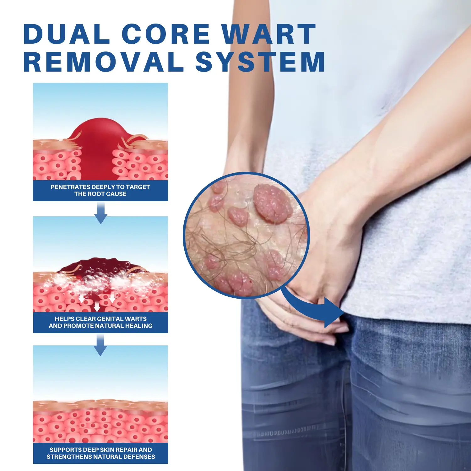 Advanced HPV & Rash Relief Genital Foam - Image 4