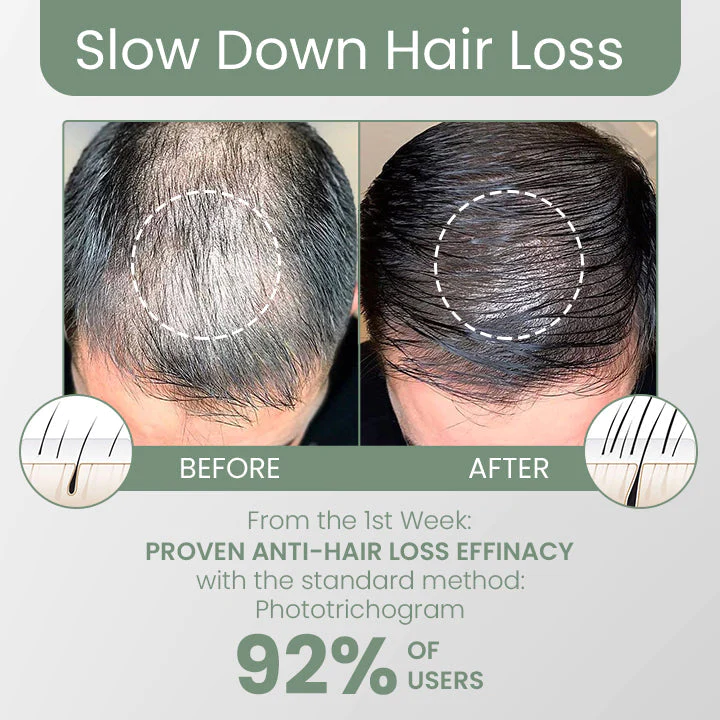 FolliclePLUS Haarwachstumstropfen - Image 4