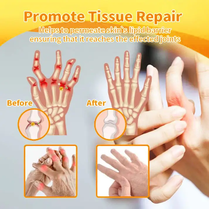 Bee Venom & Turmeric Joint and Bone Pain Relief Cream - Image 12