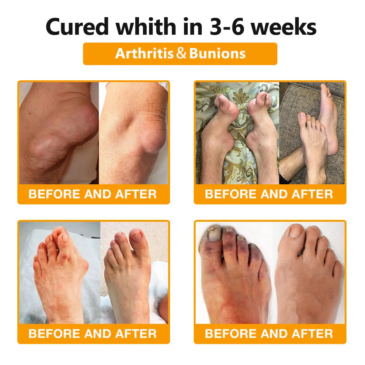 Bee Venom & Turmeric Joint and Bone Pain Relief Cream - Image 3