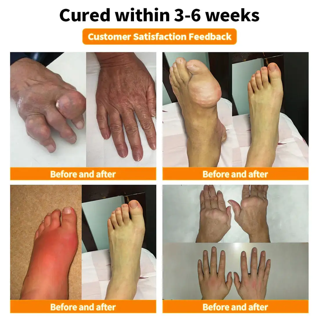 Bee Venom & Turmeric Joint and Bone Pain Relief Cream - Image 4