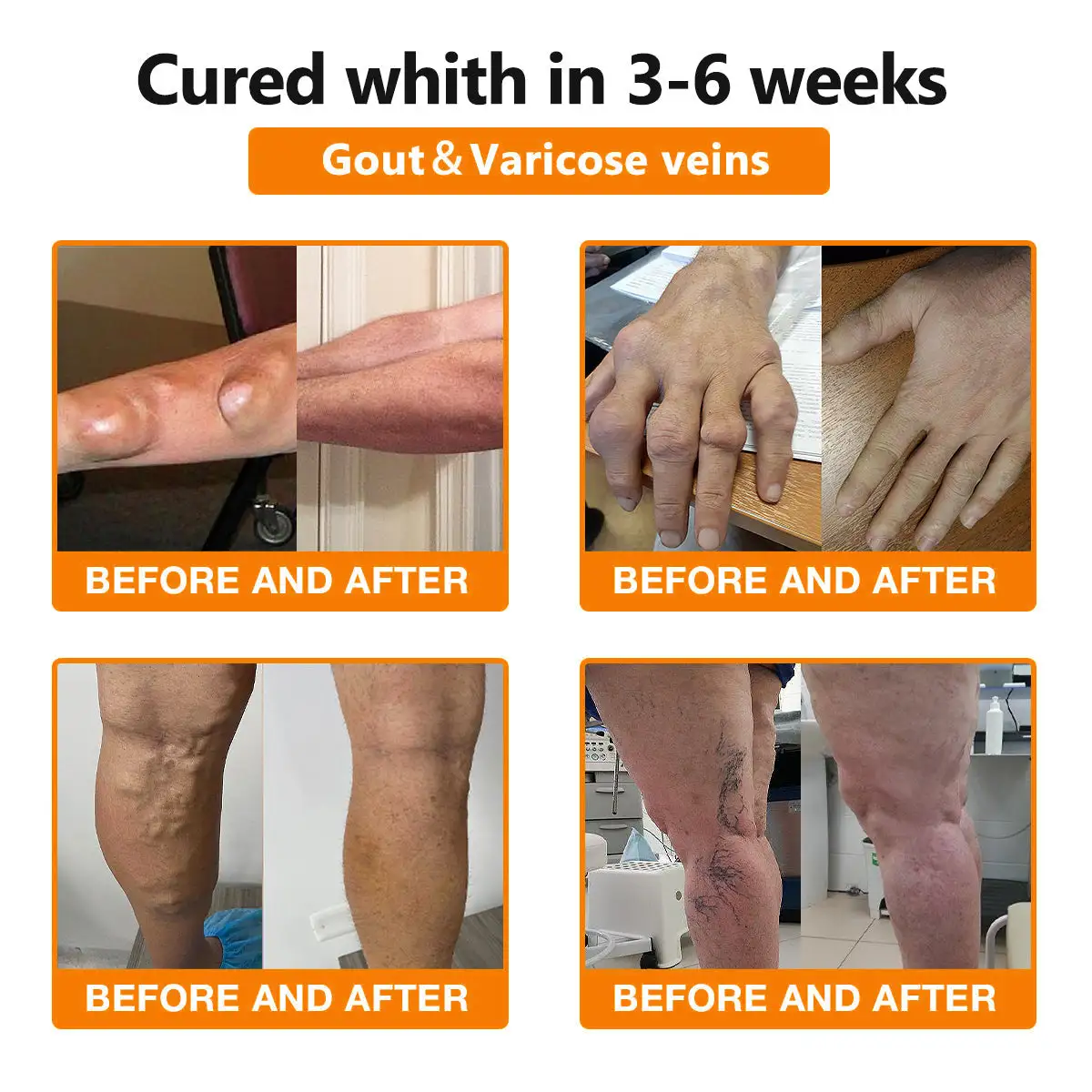 Bee Venom & Turmeric Joint and Bone Pain Relief Cream - Image 5