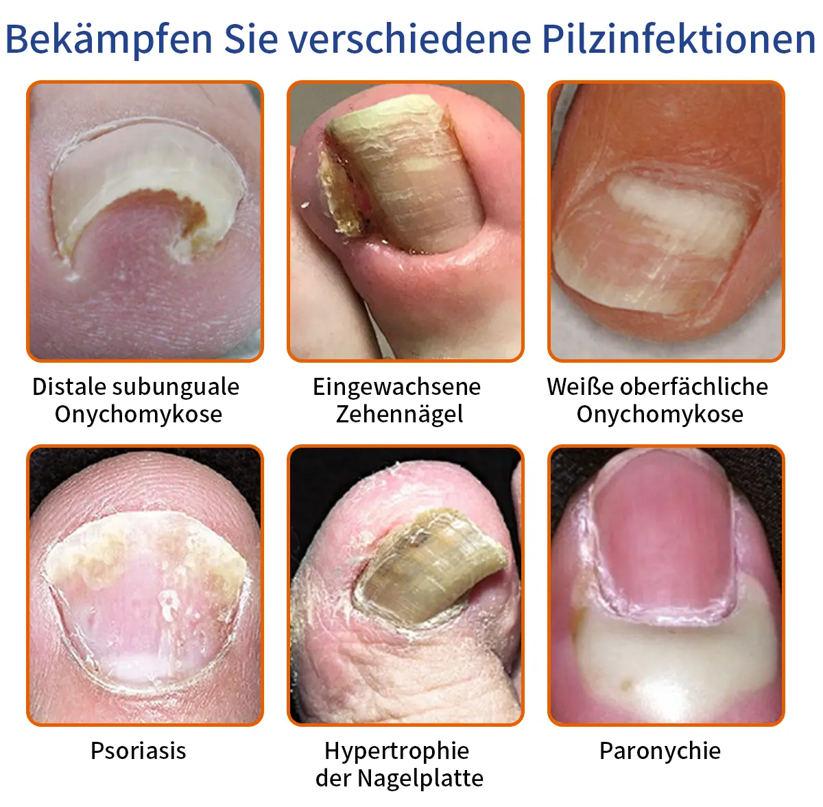 Bee Venom Nail Fungus Treatment Solution - Image 2