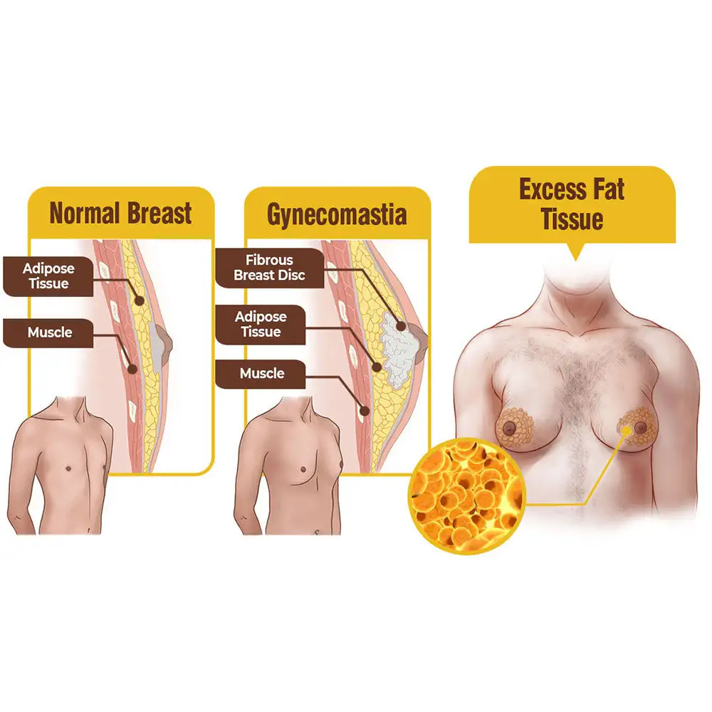 MenTough Bee Venom Gynecomastia Heating Cream - Image 6