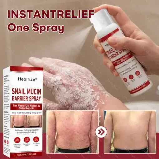 Snail Mucin Barrier Spray for Flare-Up Relief & Skin Repair - Image 2