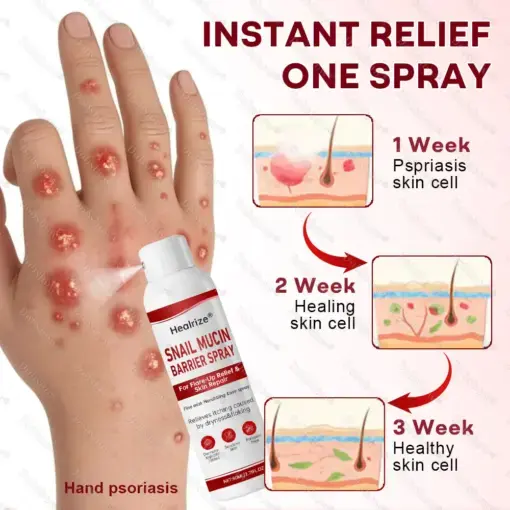 Snail Mucin Barrier Spray for Flare-Up Relief & Skin Repair - Image 5