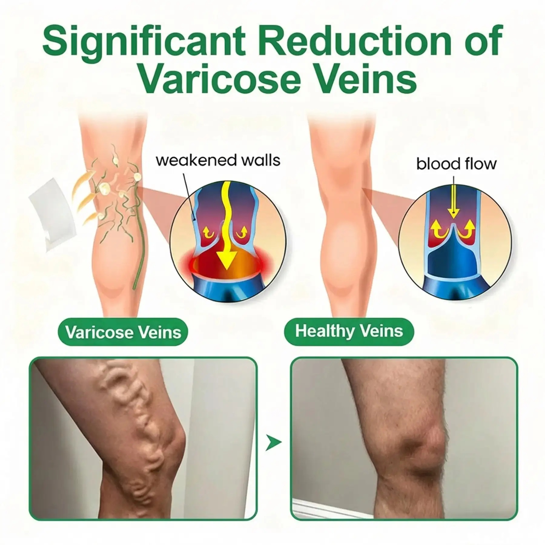 VeinEase Microneedle Care Patch⚡ - Image 4