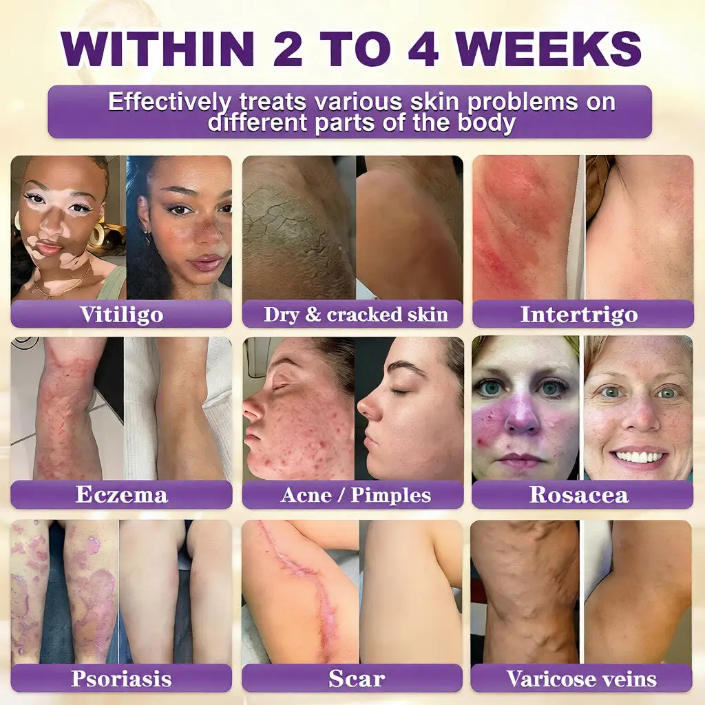 🔥LAST DAY 50% OFF Biotin 10-in-1 Skin Restoration Cream - Image 2