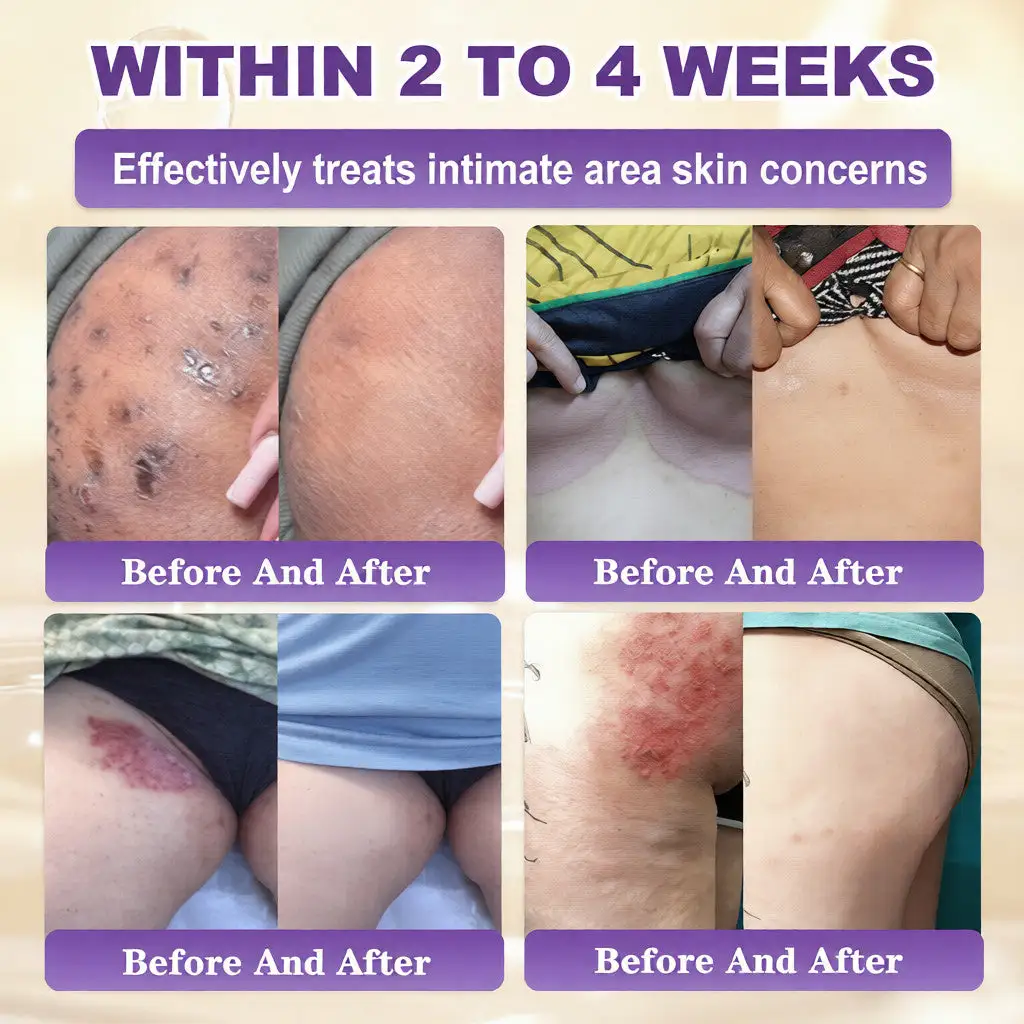 🔥LAST DAY 50% OFF Biotin 10-in-1 Skin Restoration Cream - Image 4