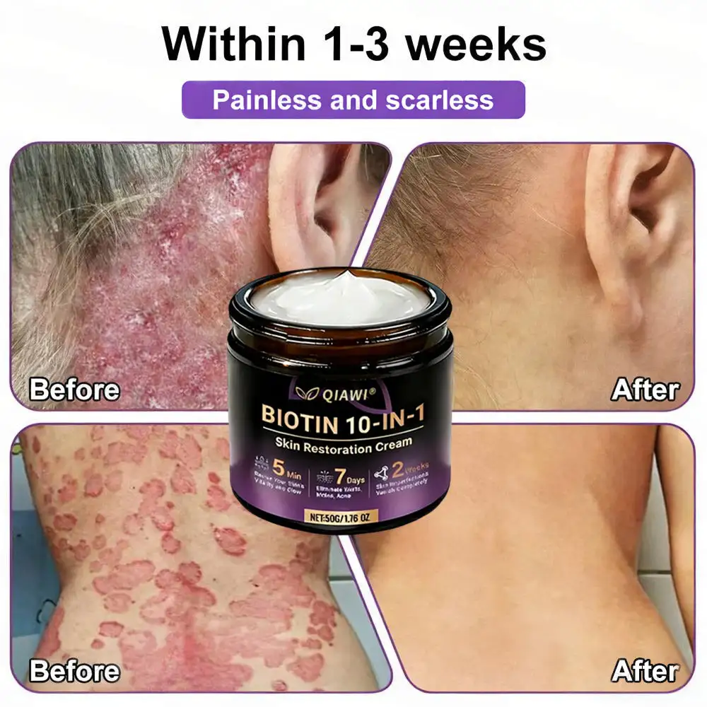 🔥LAST DAY 50% OFF Biotin 10-in-1 Skin Restoration Cream - Image 5