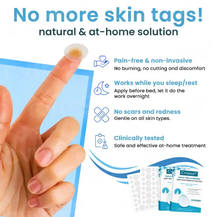 Nano-Micro Needle Skin Tags Removal Patches - Image 5