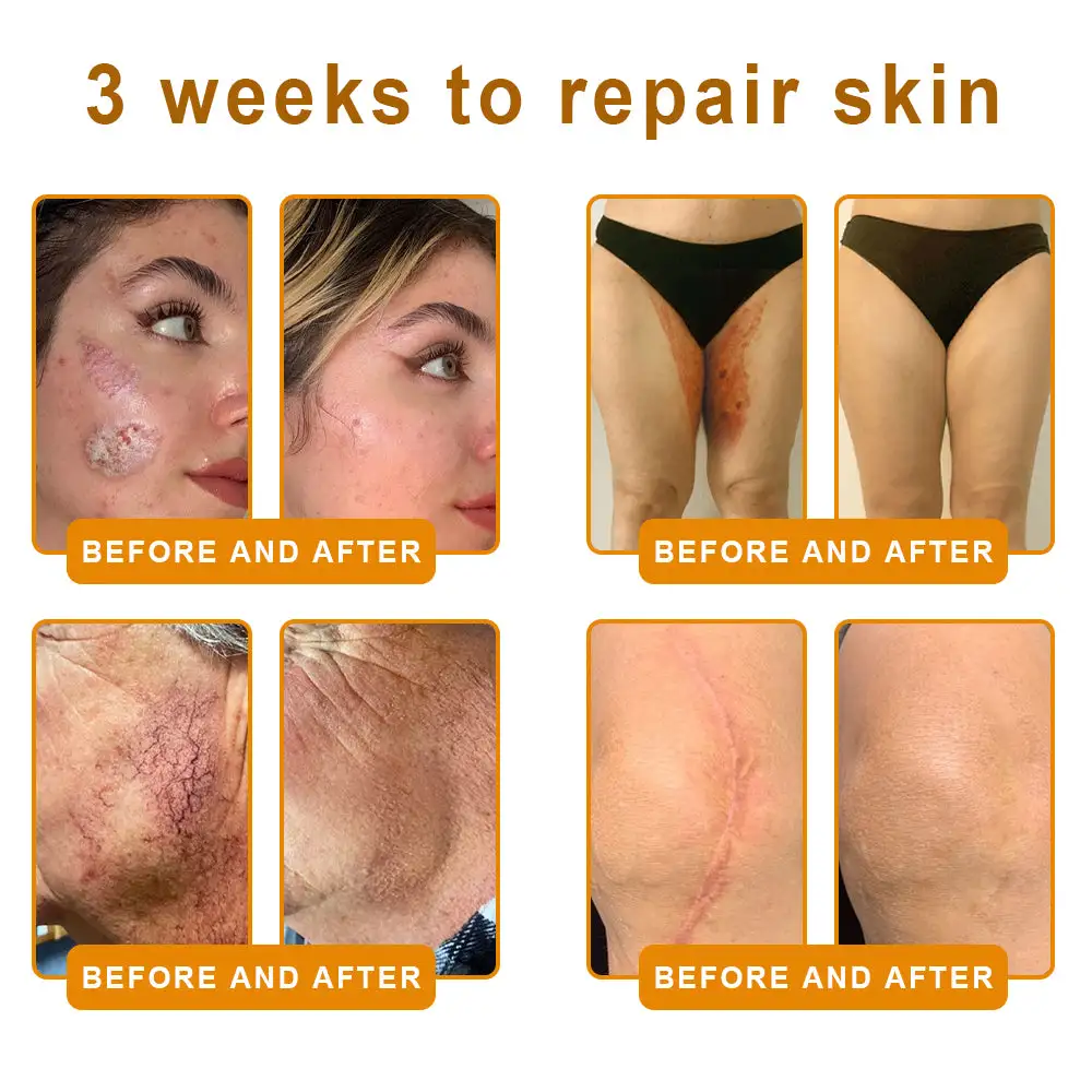 🐝Bee Poison Skin Restoration Cream 🐝 - Image 13