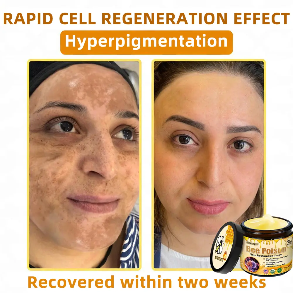 Bee Poison Skin Restoration Cream - Image 10