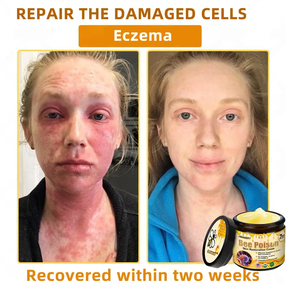 Bee Poison Skin Restoration Cream - Image 11