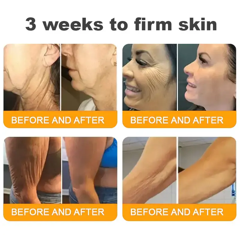 Bee Poison Skin Restoration Cream - Image 15