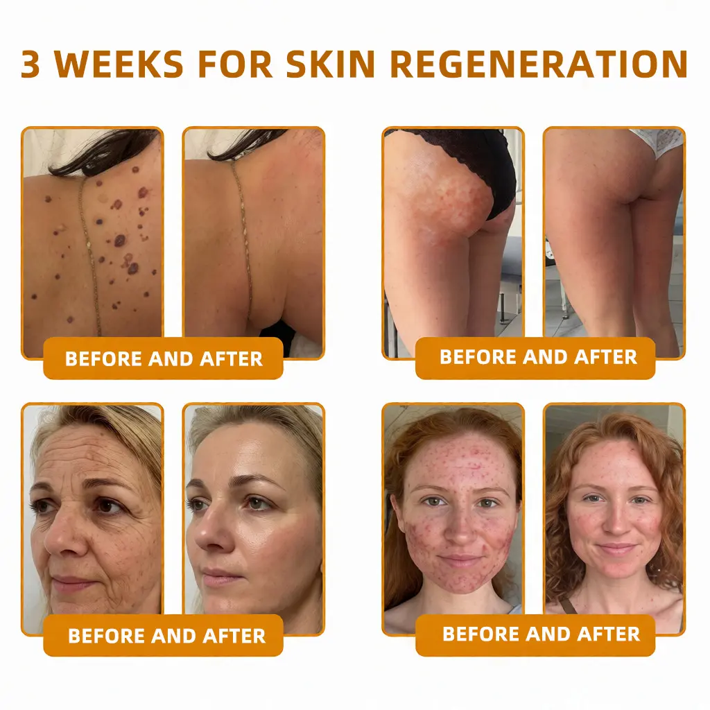 Bee Poison Skin Restoration Cream - Image 17