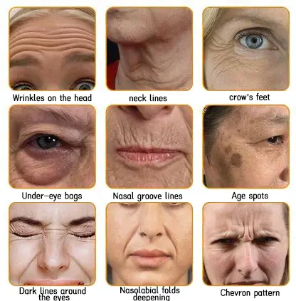 Bee Poison Skin Restoration Cream - Image 18