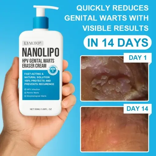 NANOLIPO HPV GENITAL WARTS ERASER CREAM - Image 2