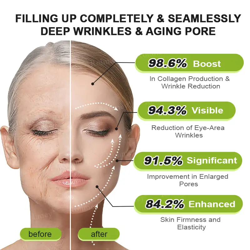 ⏰ Last Day! 70% OFF 💫 Botox & Vita-A Retinol Wrinkle-Lift Cream – Made & Shipped from CA 🔥 - Image 16