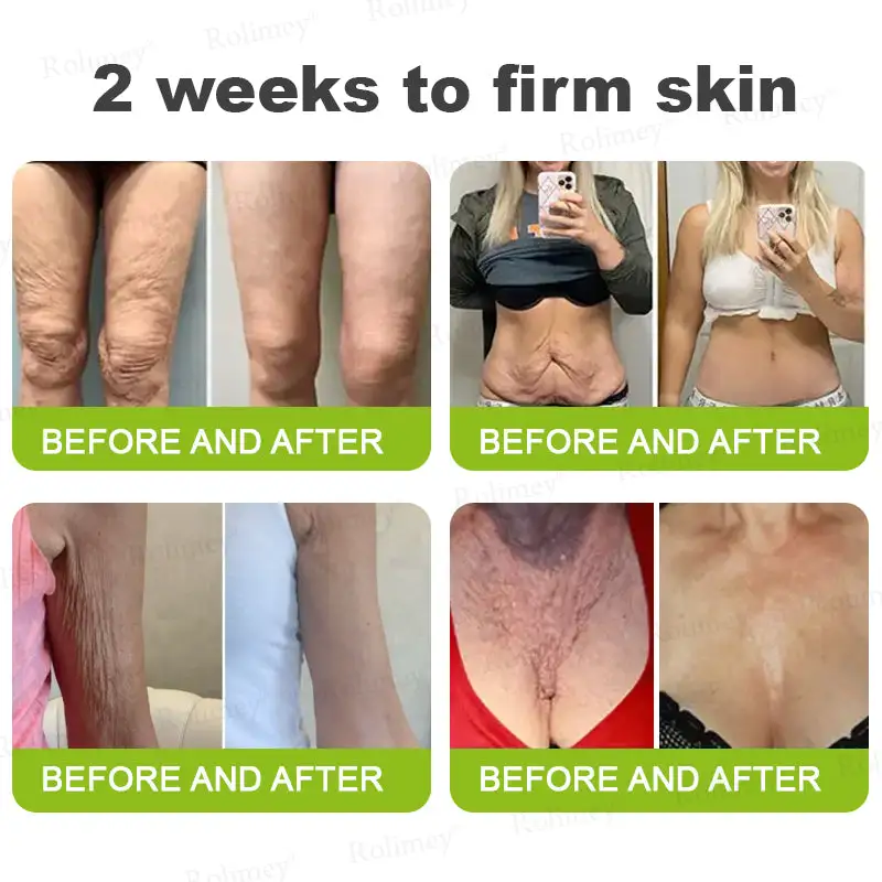 ⏰ Last Day! 70% OFF 💫 Botox & Vita-A Retinol Wrinkle-Lift Cream – Made & Shipped from CA 🔥 - Image 8