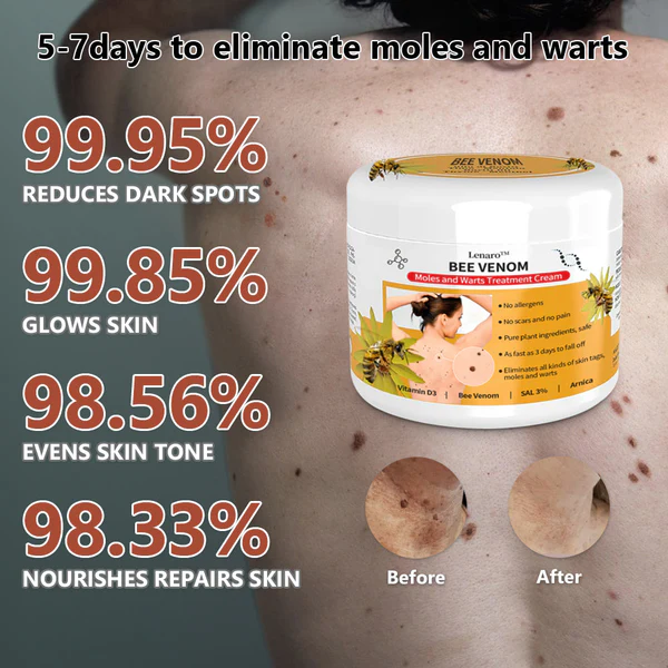 Bee Venom Mole and Wart Treatment Cream - Image 4