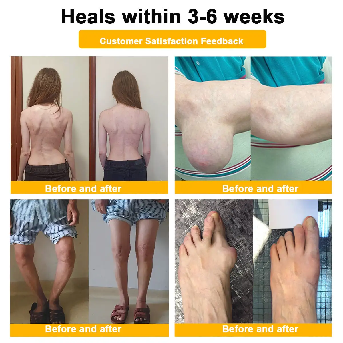 Botulinum Toxin & Bee Venom Pain-Relief Bone Healing Cream - Image 12
